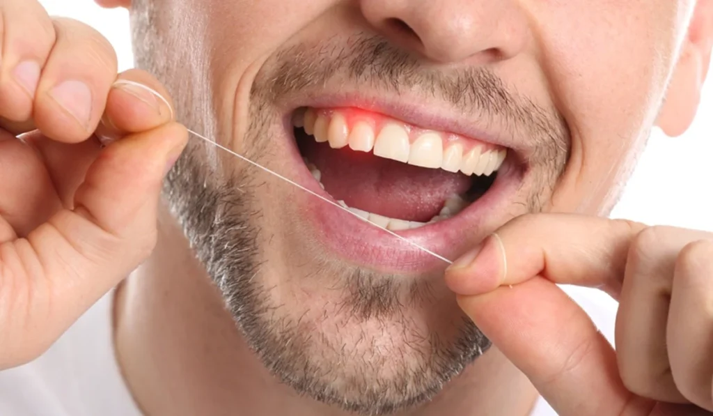 Comment repérer les signes précoces de maladie gingivale - Dr Jihene Helal - Médecin dentiste - Tunisie - Sousse