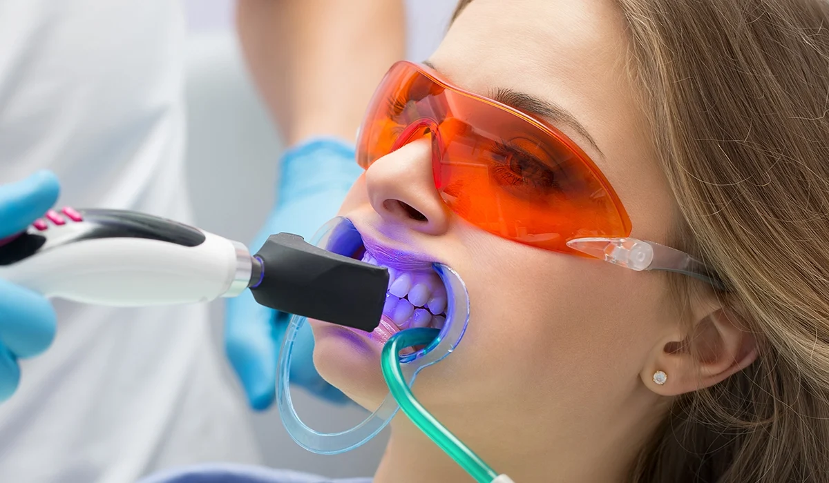 Contournage des gencives au laser Pour un sourire harmonieux - Dr Jihene Helal - Médecin dentiste - Tunisie - Sousse